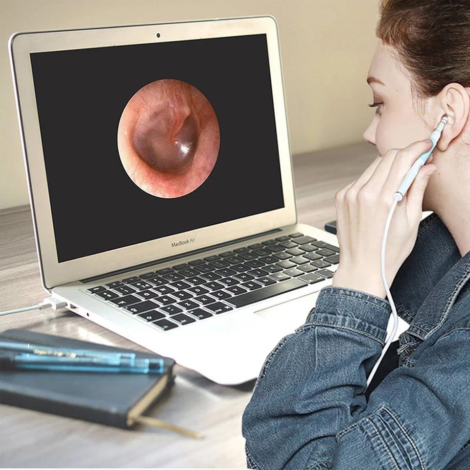 Otoscope électronique