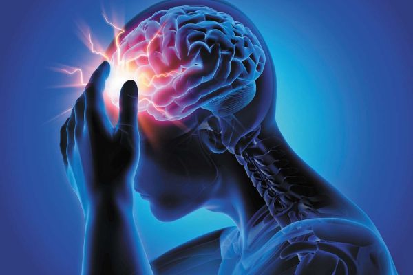 migraine ophtalmique avec aura
